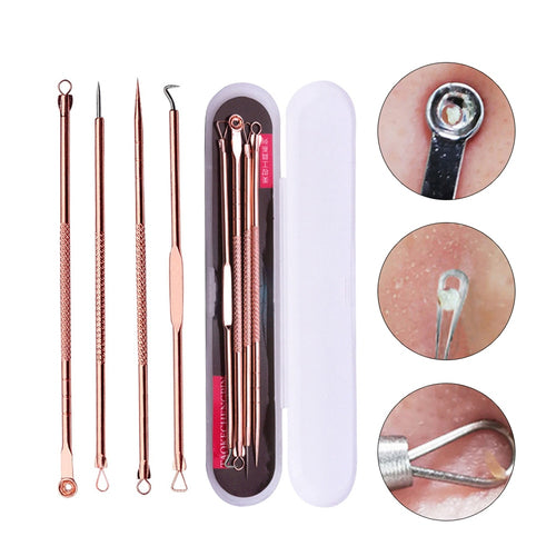 4PCS Blackhead Extractor de cravo Rose Gold Black Dots Cleaner Acne Blemish Remover Needles Set Black Spots Pore Cleanser Tool